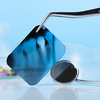 dental-xray dental-xray